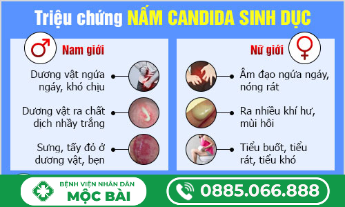 NGUYÊN NHÂN BỊ NẤM SINH DỤC