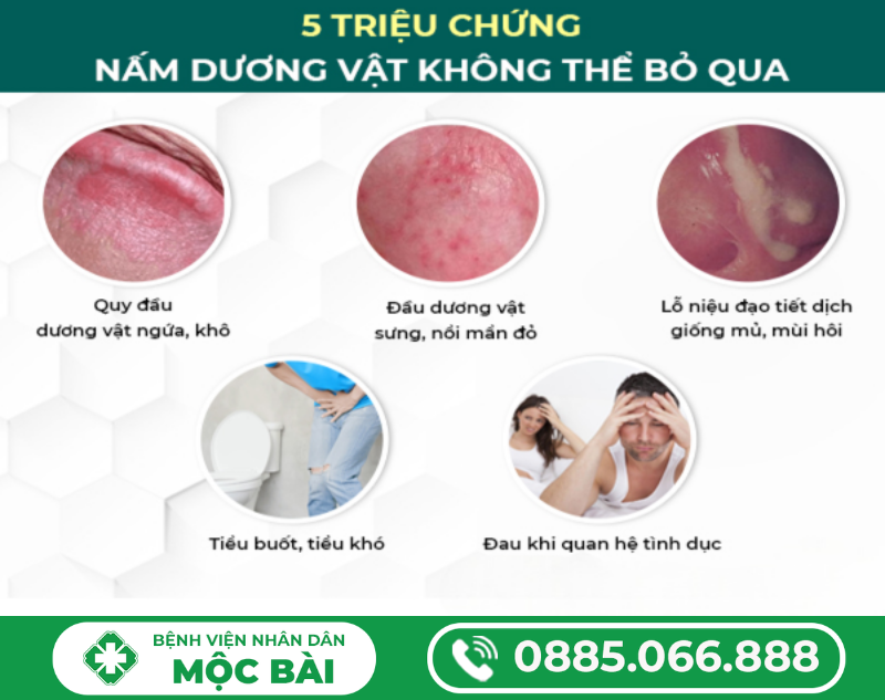 CHỮA BỆNH NẤM Ở BỘ PHẬN SINH DỤC NAM