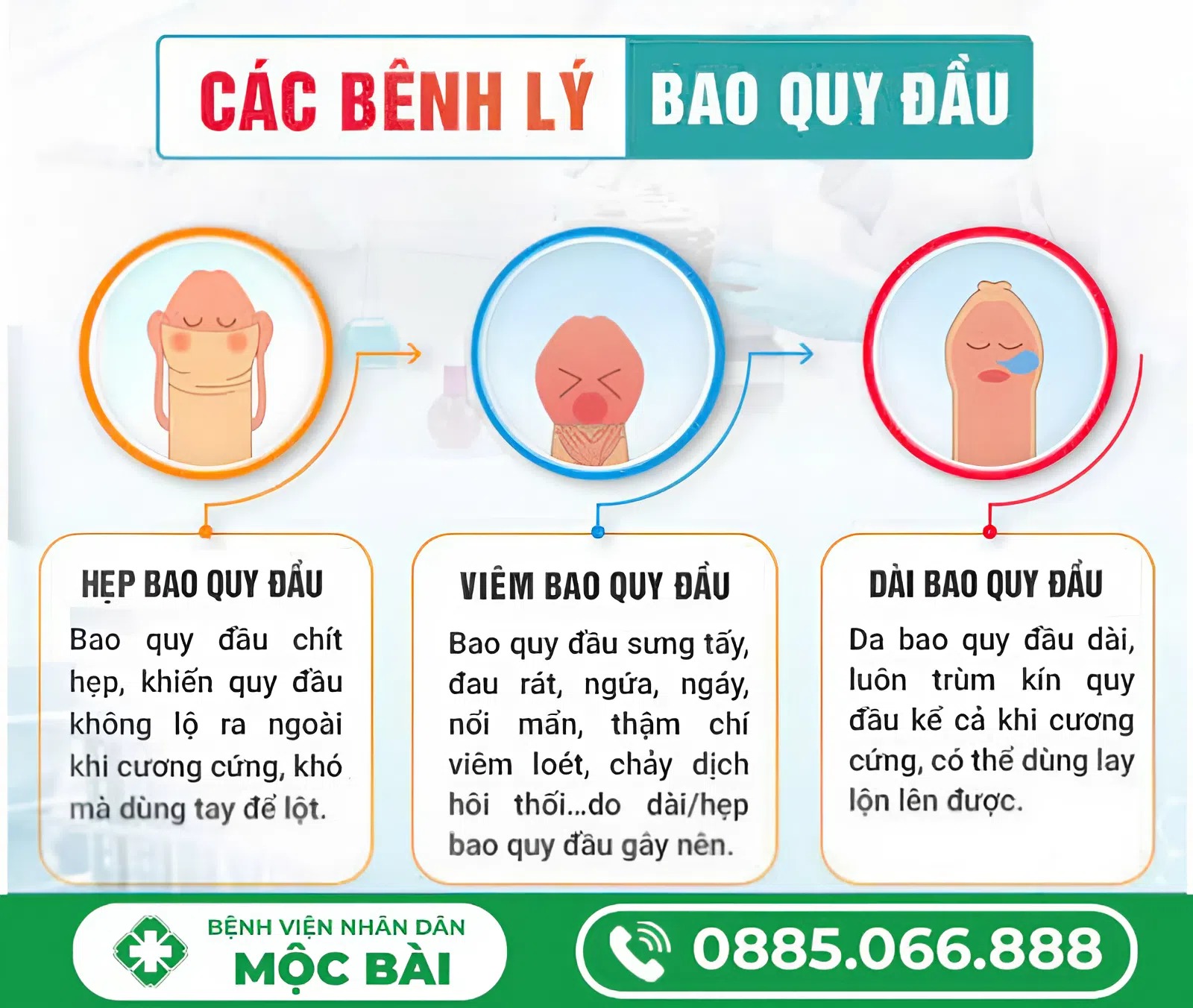 TÌM HIỂU CẮT BAO QUY ĐẦU LÀ GÌ?