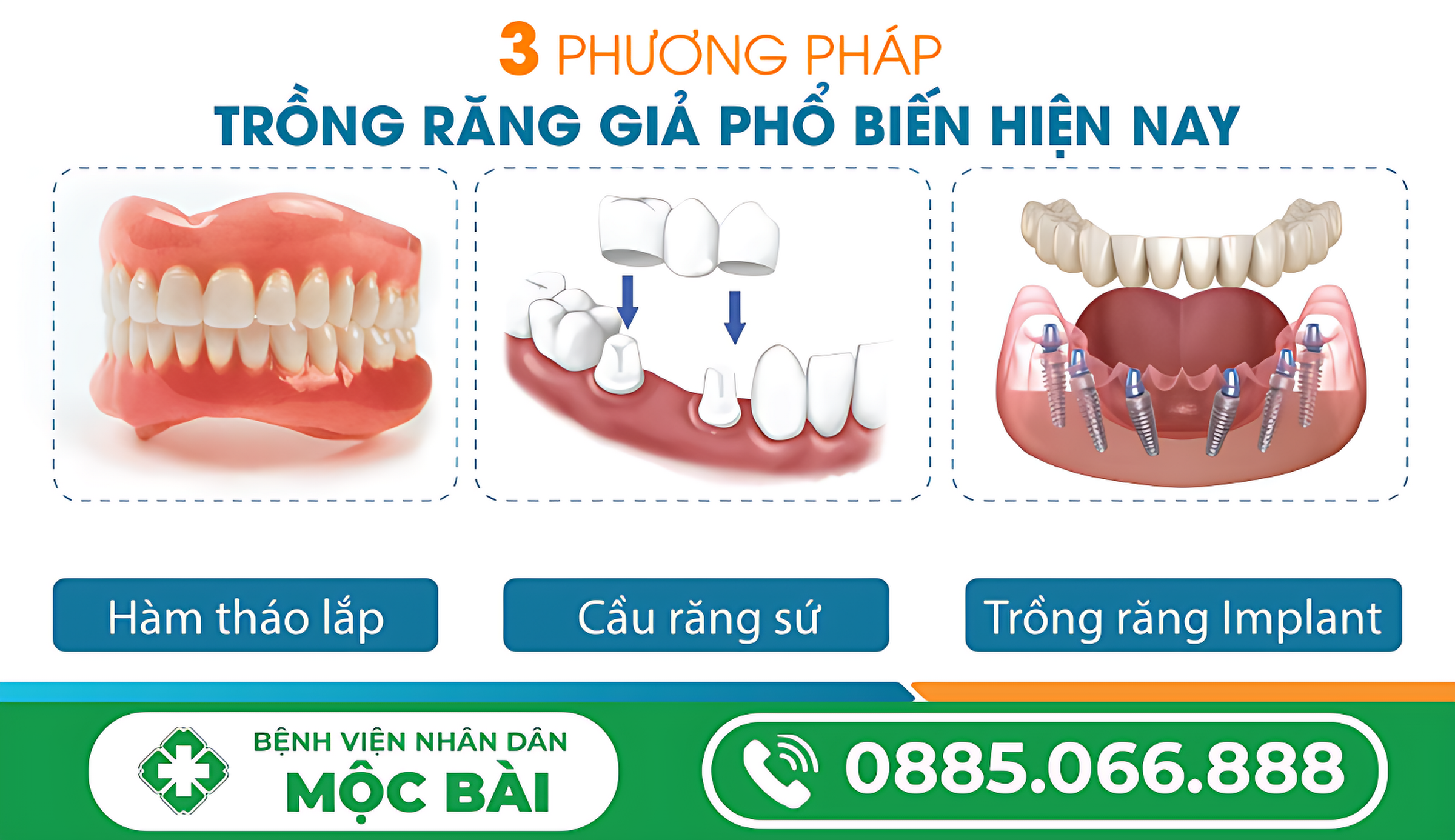 PHƯƠNG PHÁP TRỒNG RĂNG GIẢ AN TOÀN, THẨM MỸ HIỆN NAY