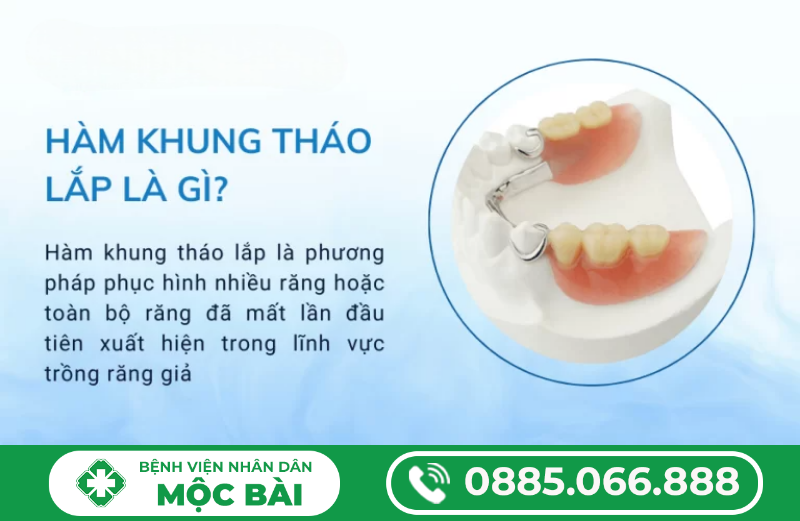 CÁC LOẠI HÀM RĂNG GIẢ THÁO LẮP