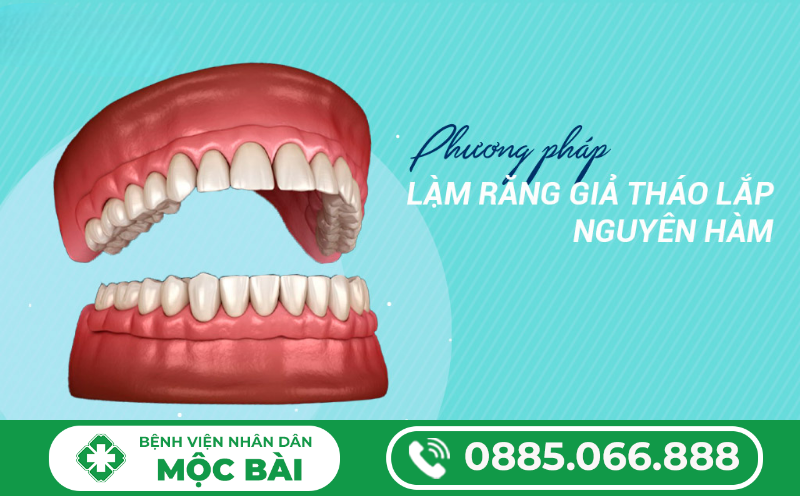 TÌM HIỂU HÀM GIẢ THÁO LẮP TỪNG PHẦN