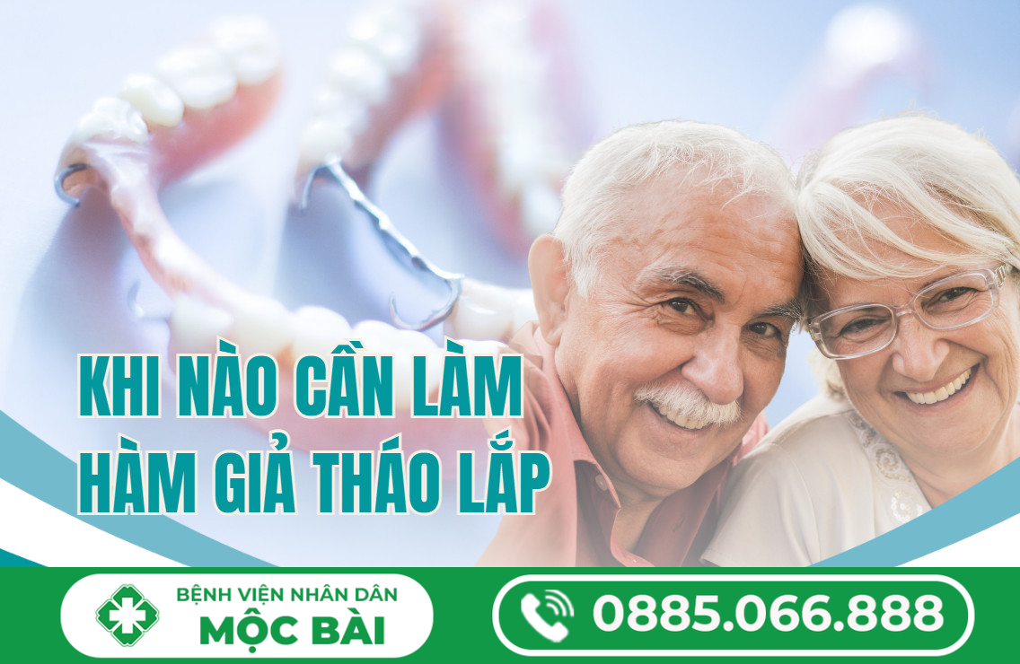 TÌM HIỂU HÀM GIẢ THÁO LẮP LÀ GÌ?