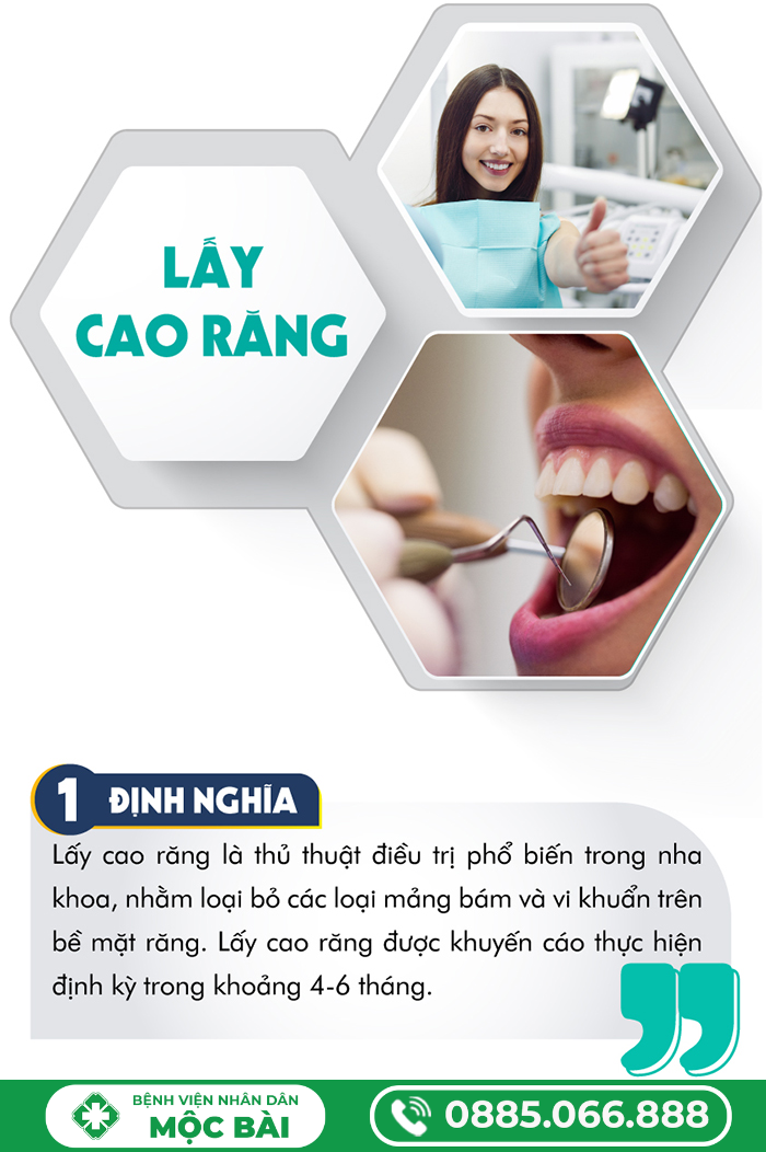 KHI NÀO THÌ CẦN LẤY CAO RĂNG?