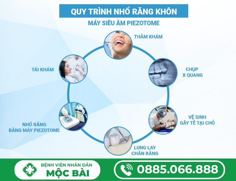 QUY TRÌNH NHỔ RĂNG KHÔN HIỆN ĐẠI – AN TOÀN – NHANH CHÓNG