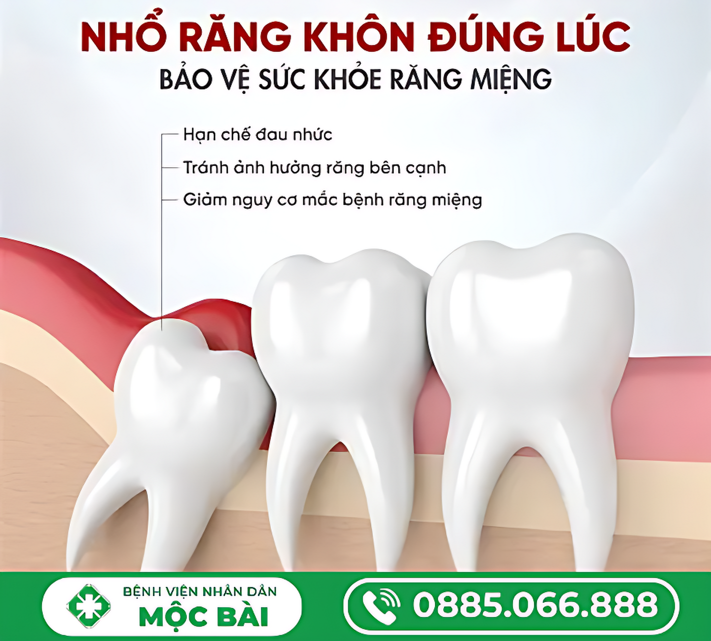 KHI NÀO NÊN NHỔ RĂNG KHÔN?