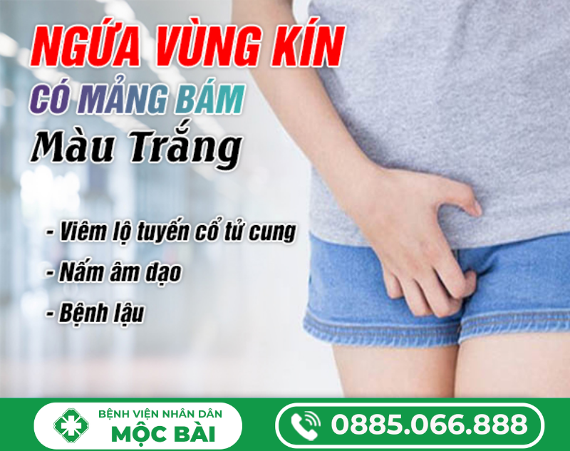 NGỨA VÙNG KÍN CÓ MẢNG BÁM MÀU TRẮNG