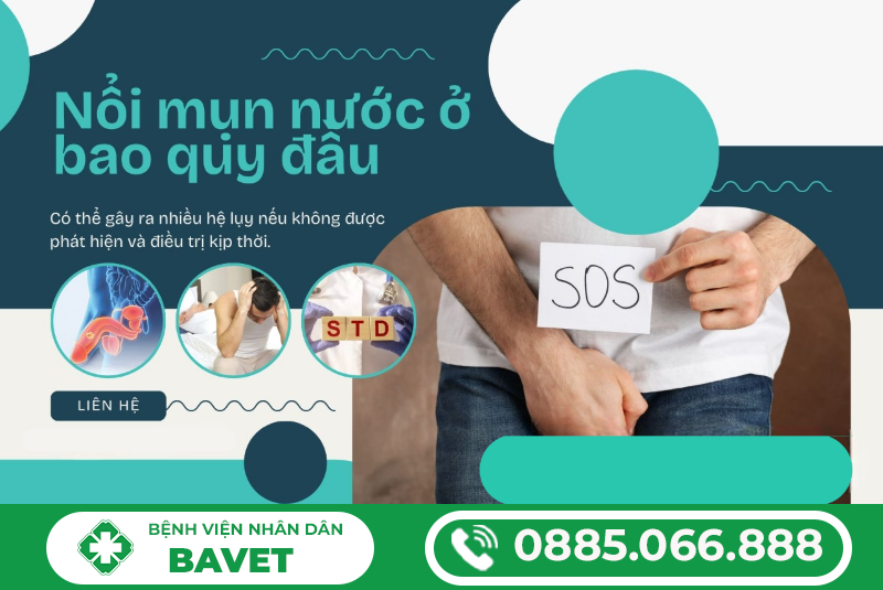 NỔI MỤN NƯỚC Ở BAO QUY ĐẦU