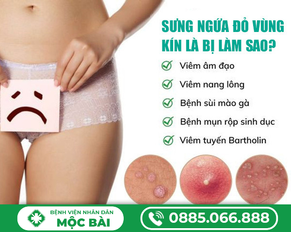 SƯNG NGỨA ĐỎ VÙNG KÍN LÀ BỆNH GÌ?
