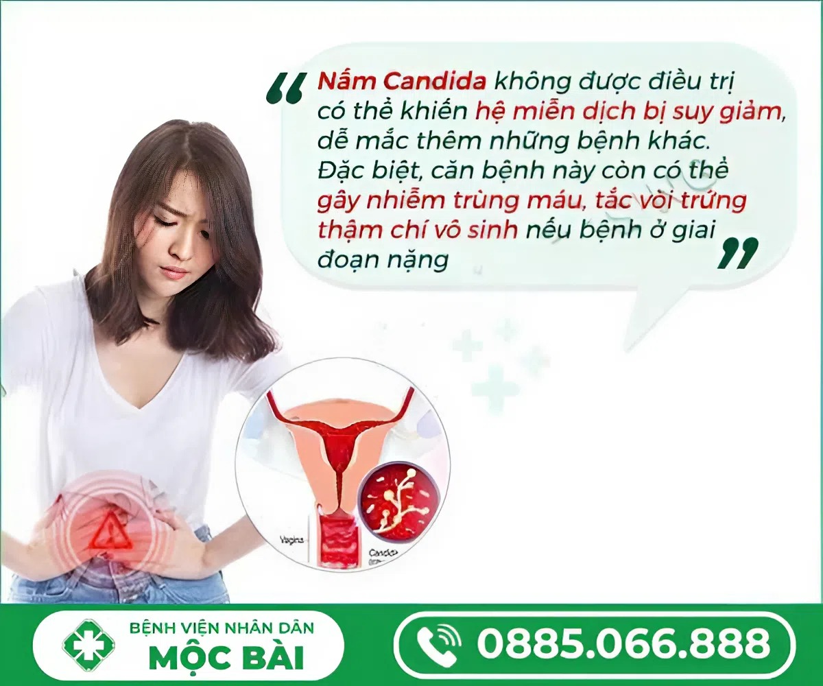 NẤM VÙNG KÍN Ở NỮ GIỚI