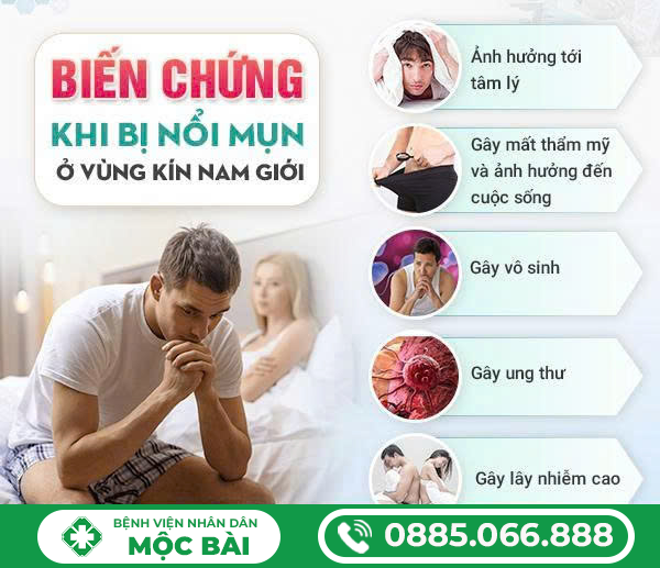 NỔI MỤN LI TI Ở BAO QUY ĐẦU
