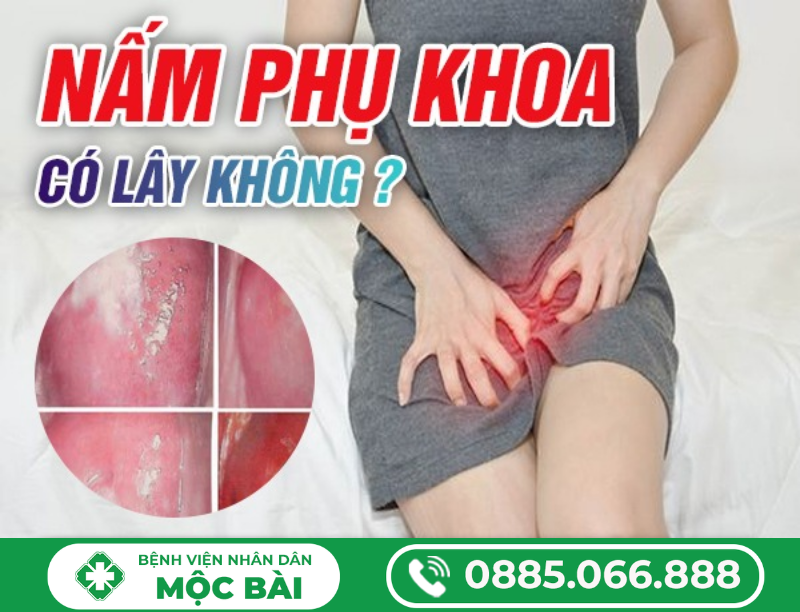 NẤM PHỤ KHOA CÓ LÂY KHÔNG?