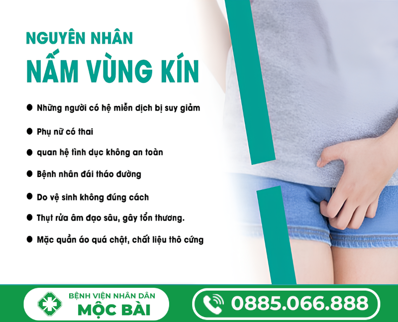 NGUYÊN NHÂN GÂY NẤM PHỤ KHOA