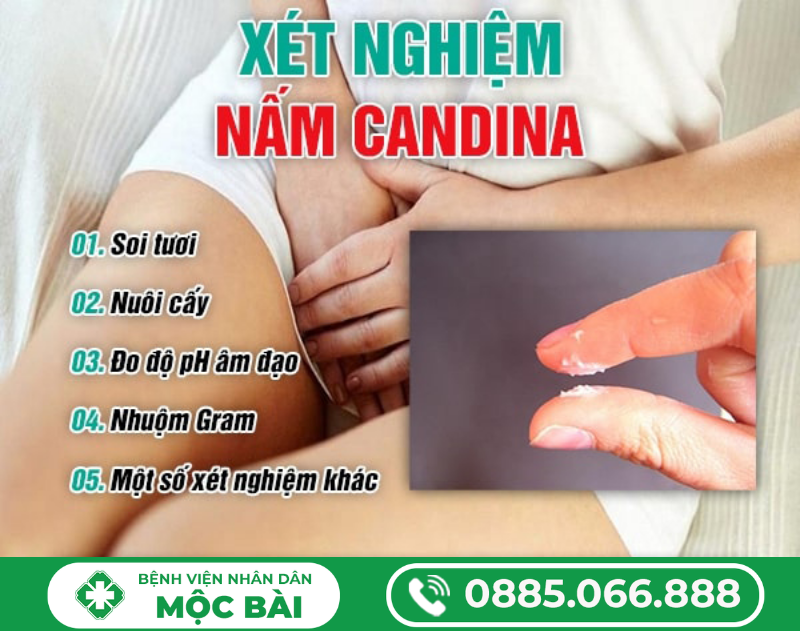 XÉT NGHIỆM NẤM PHỤ KHOA