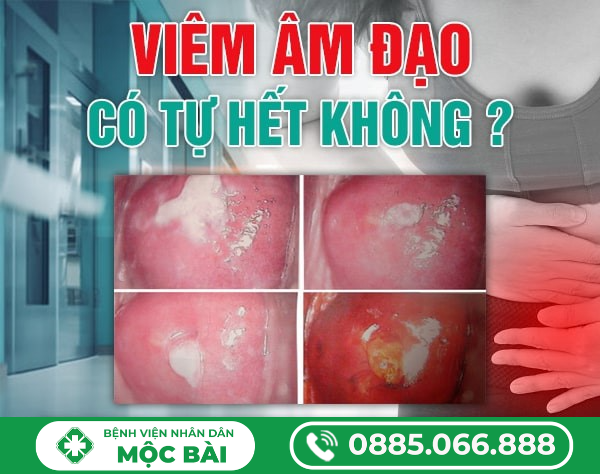 VIÊM ÂM ĐẠO TỰ HẾT KHÔNG?