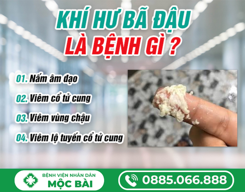 KHÍ HƯ BÃ ĐẬU LÀ GÌ? DẤU HIỆU VIÊM PHỤ KHOA KHÔNG NÊN CHỦ QUAN