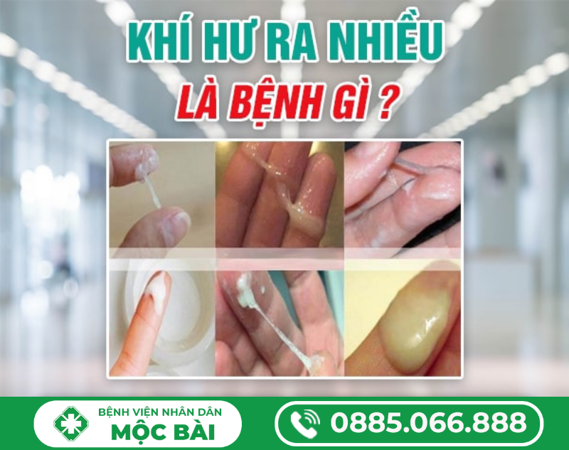 KHÍ HƯ RA NHIỀU LÀ BỆNH GÌ?