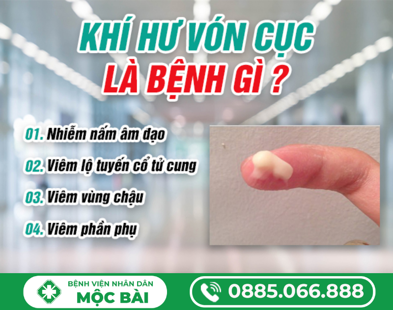 KHÍ HƯ VÓN CỤC LÀ GÌ? CÓ NGUY HIỂM KHÔNG?