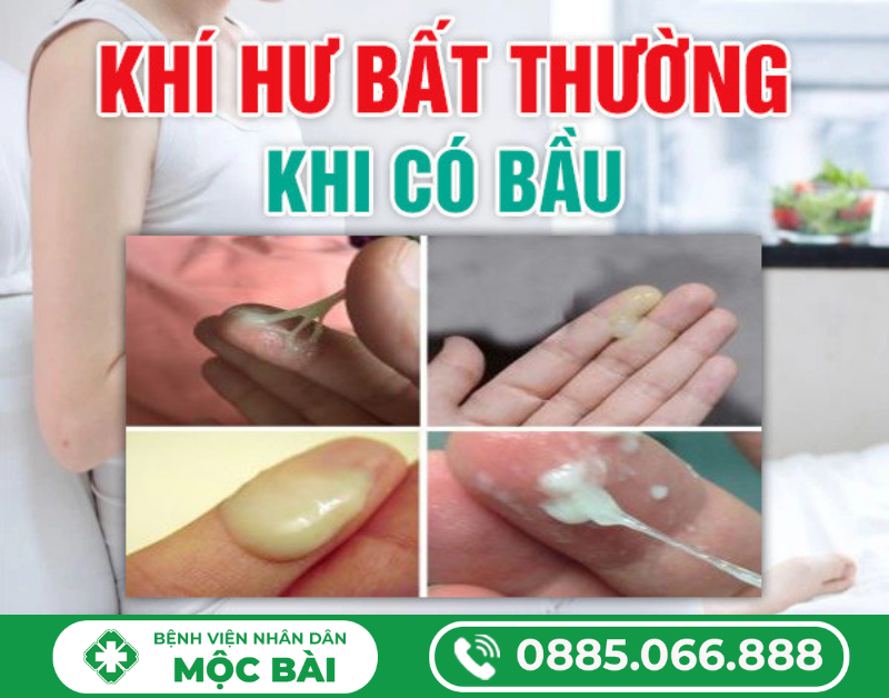 KHÍ HƯ BẤT THƯỜNG KHI CÓ BẦU