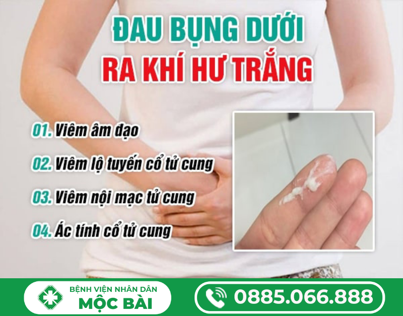 ĐAU BỤNG DƯỚI RA KHÍ HƯ TRẮNG
