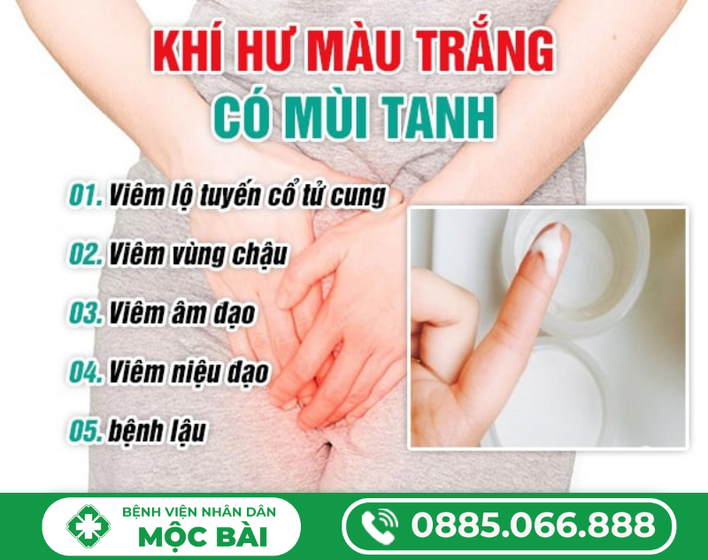 KHÍ HƯ MÀU TRẮNG CÓ MÙI TANH LÀ DẤU HIỆU BỆNH GÌ?