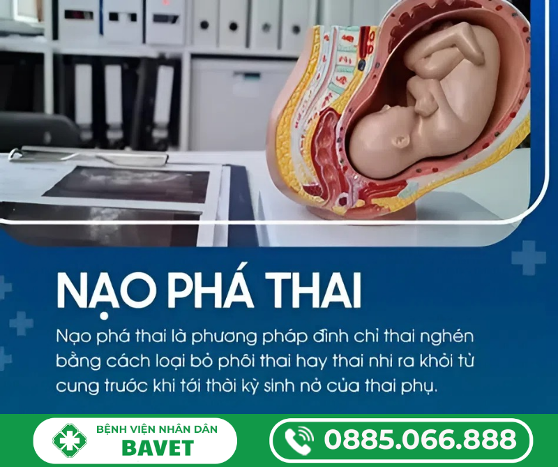 NẠO HÚT THAI LÀ GÌ?