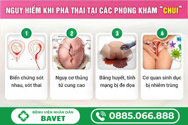 CÁCH BỎ THAI NGOÀI Ý MUỐN AN TOÀN