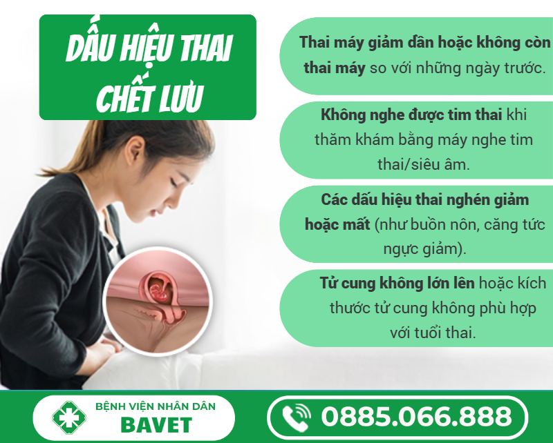 BỊ THAI LƯU CÓ BIỂU HIỆN GÌ?