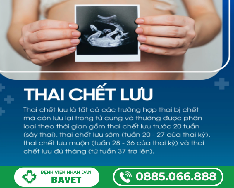 TÌM HIỂU THÔNG TIN THAI LƯU LÀ GÌ?