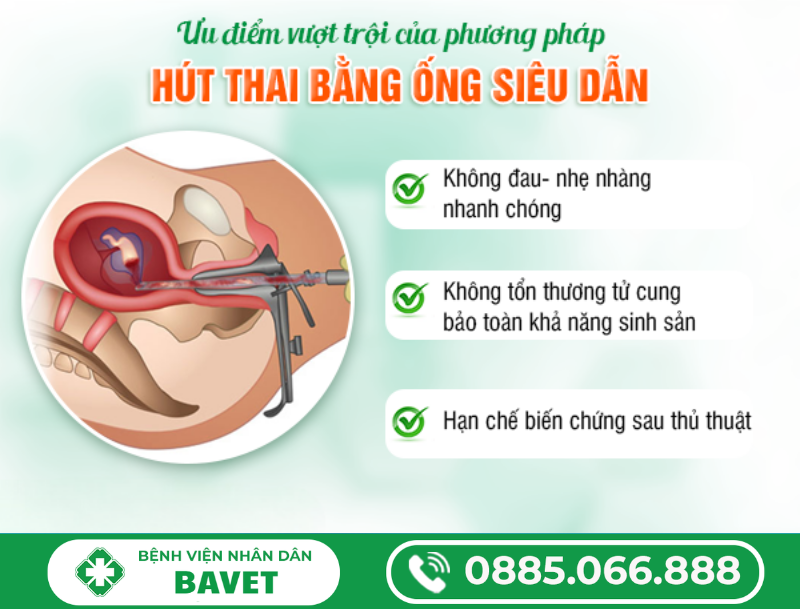 THỦ THUẬT HÚT THAI LƯU CHUẨN Y KHOA