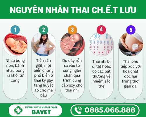 CÁC NGUYÊN NHÂN GÂY THAI LƯU
