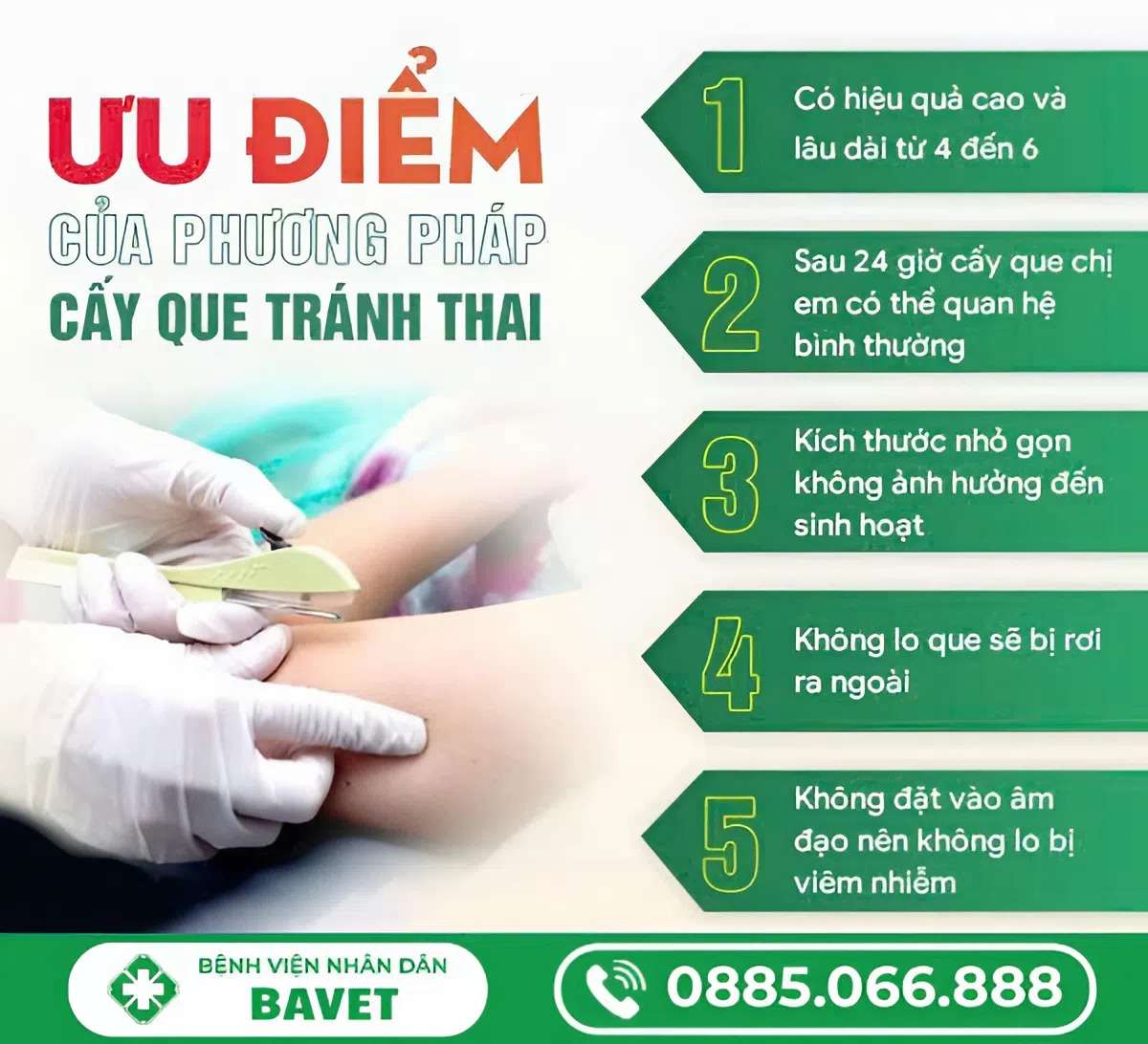 GIẢI ĐÁP: CẤY QUE TRÁNH THAI CÓ AN TOÀN KHÔNG?