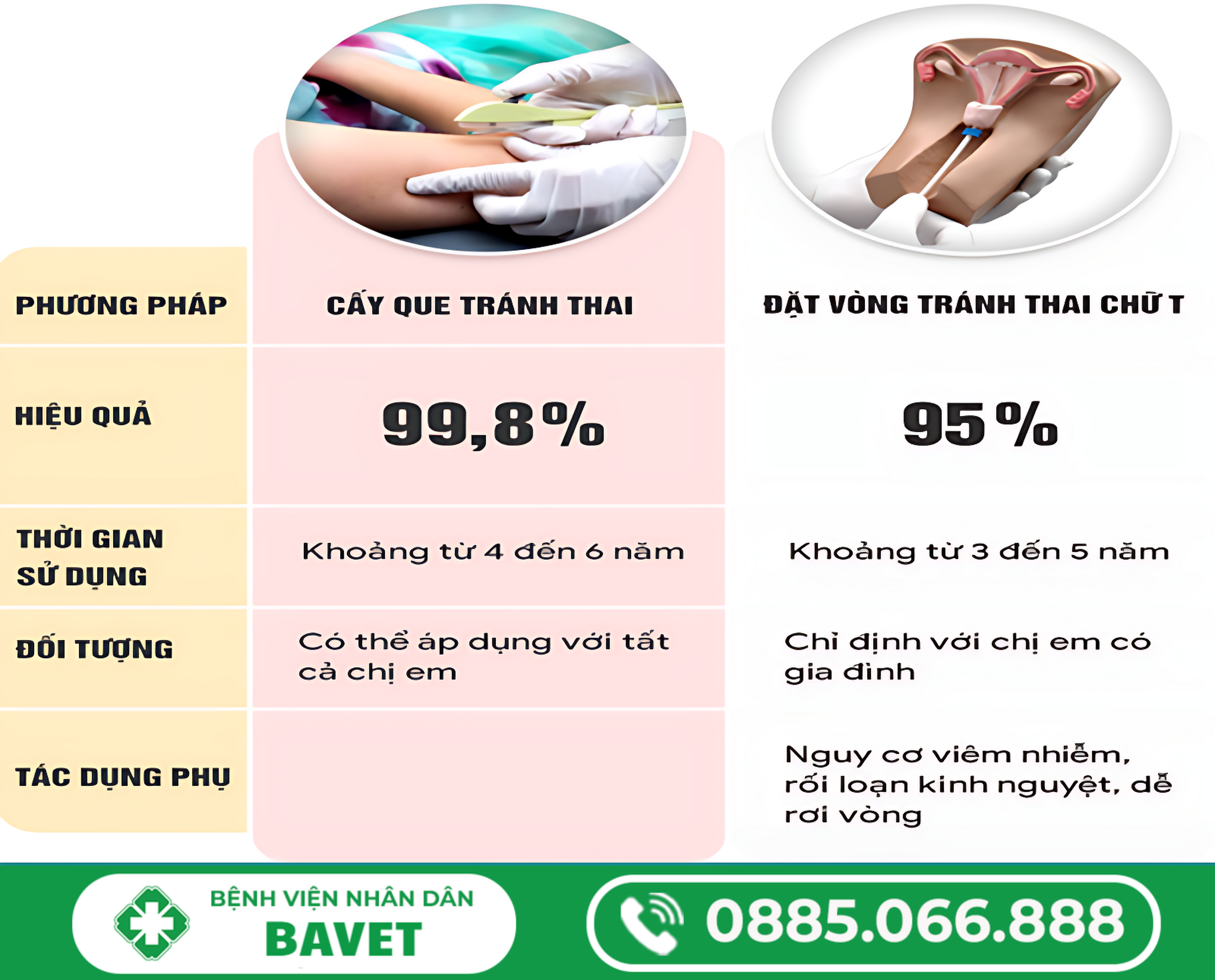 NÊN CHỌN CẤY QUE TRÁNH THAI HAY ĐẶT VÒNG TRÁNH THAI?