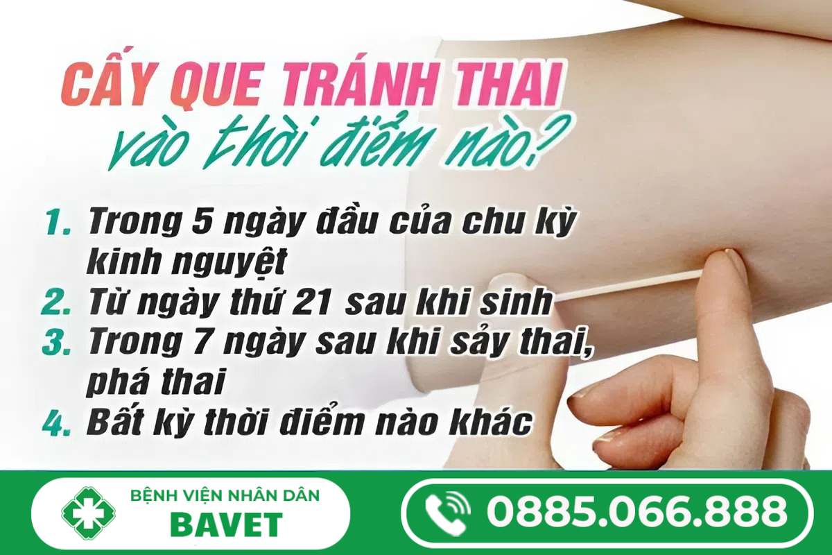 NÊN CẤY QUE TRÁNH THAI VÀO THỜI ĐIỂM NÀO?