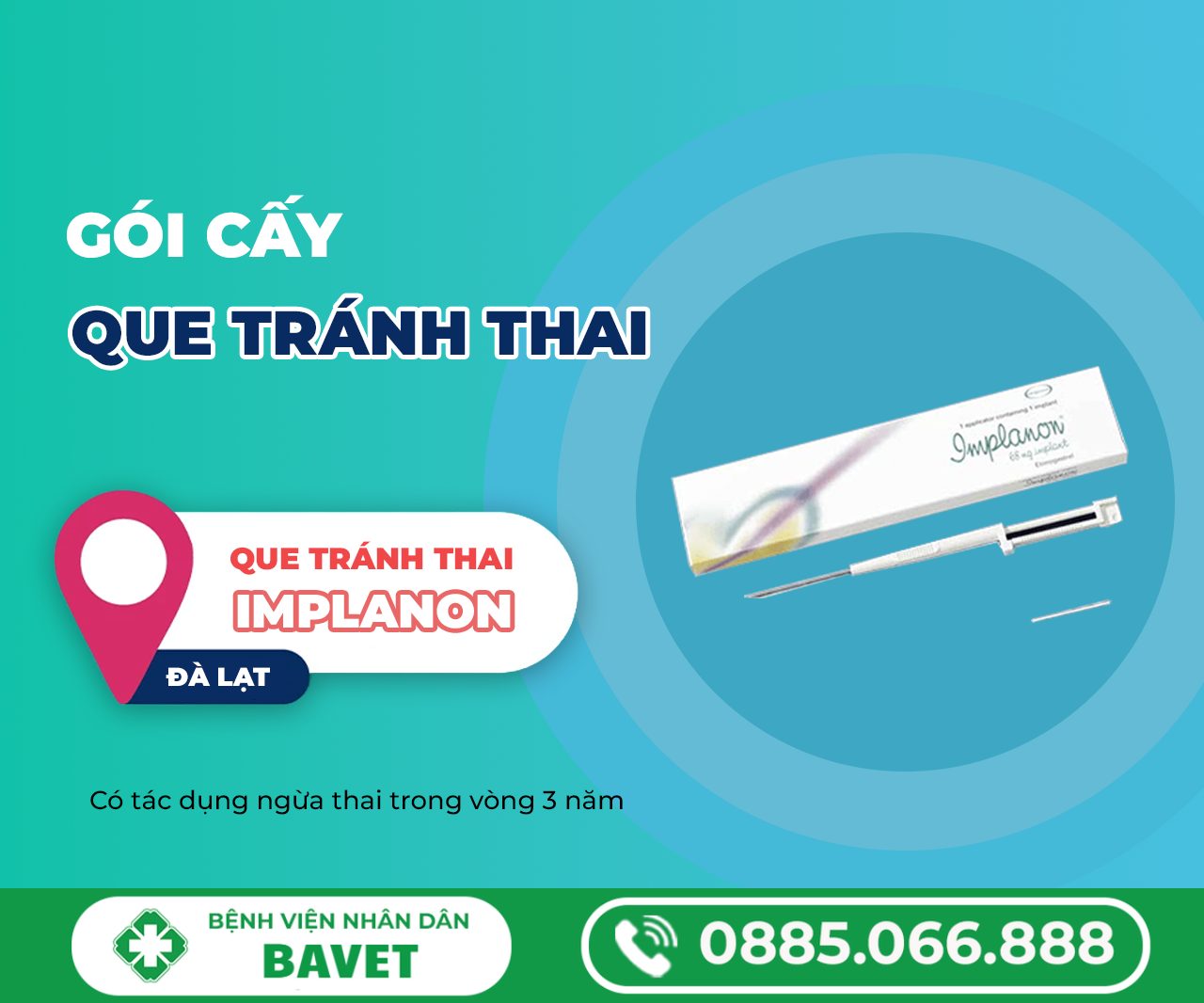 TÌM HIỂU VỀ CHI PHÍ CẤY QUE TRÁNH THAI