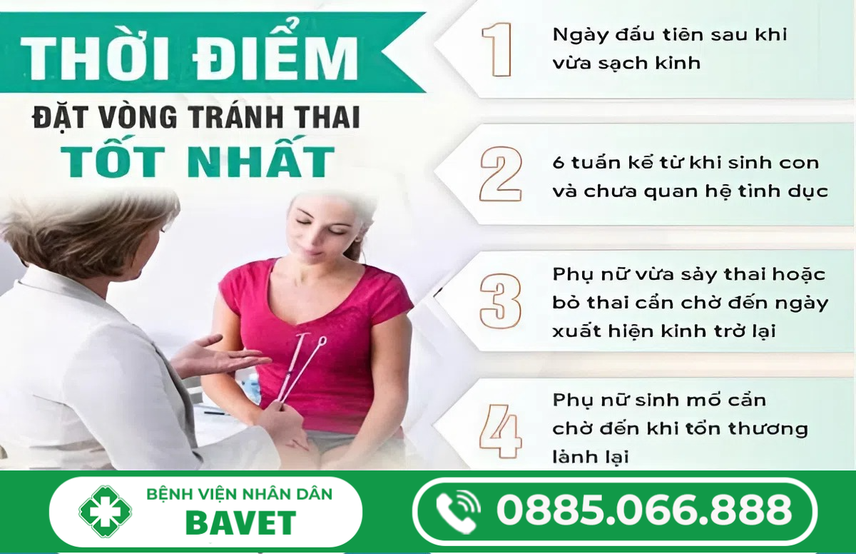 KHI NÀO NÊN ĐẶT VÒNG TRÁNH THAI LÀ TỐT NHẤT?