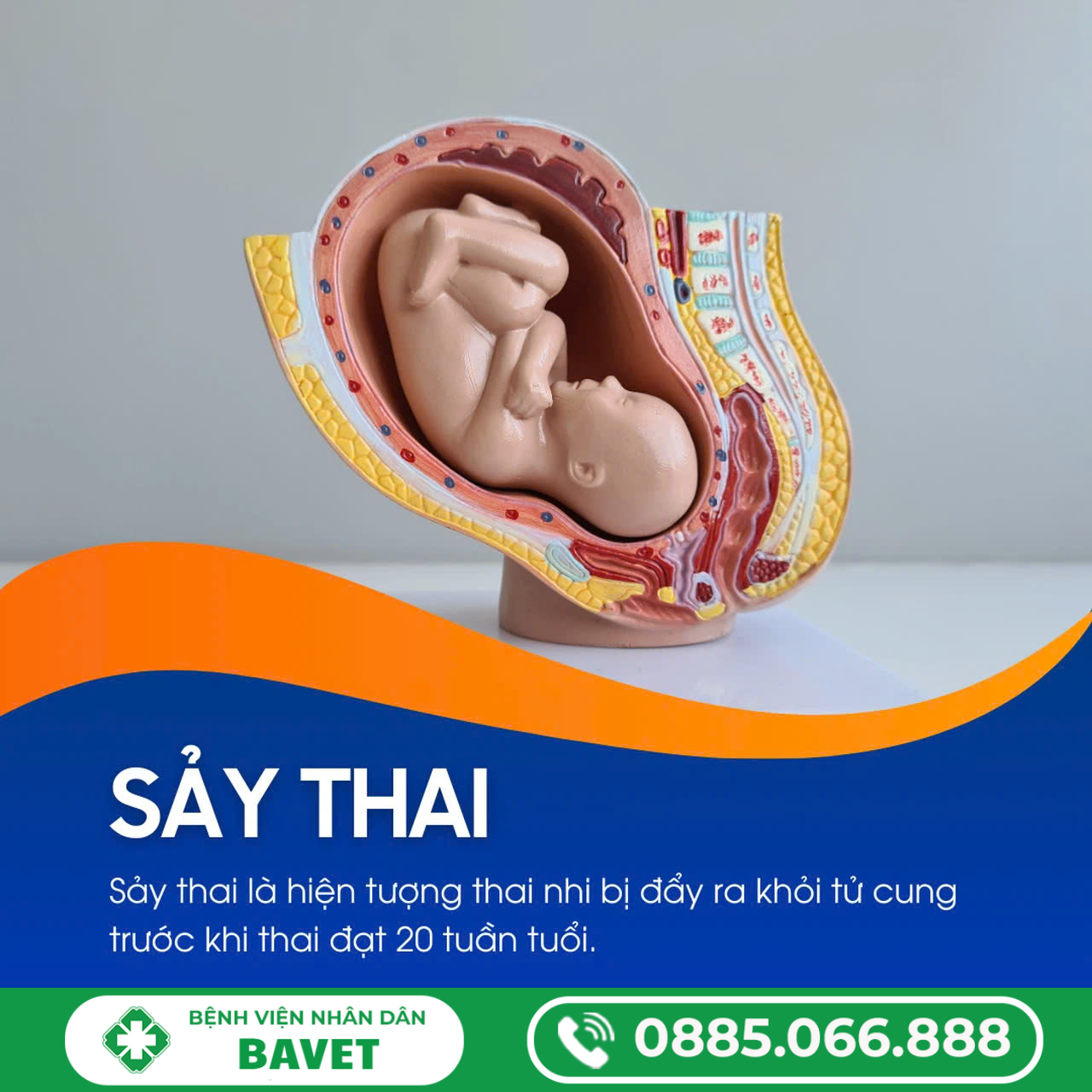 SẢY THAI LÀ GÌ? NHỮNG ĐIỀU MẸ BẦU CẦN BIẾT