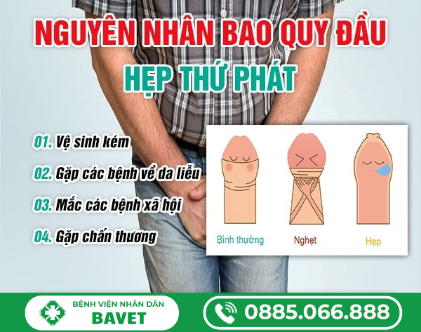 BAO QUY ĐẦU HẸP THỨ PHÁT LÀ GÌ?