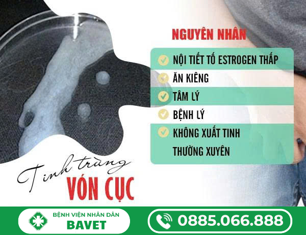 TẠI SAO TINH TRÙNG VÓN CỤC?