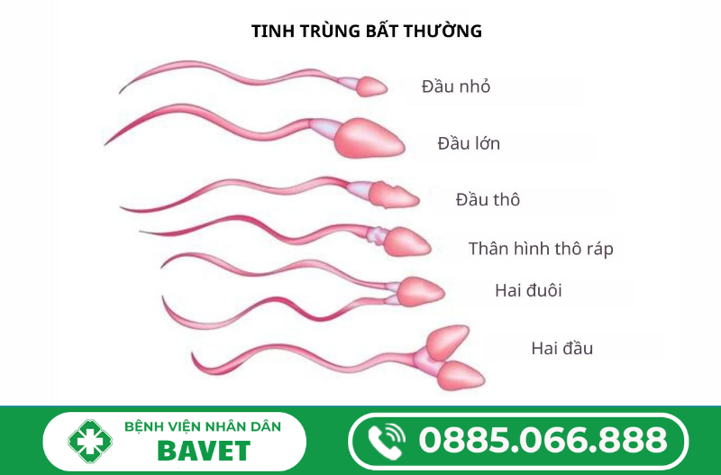 TINH TRÙNG CÓ MÙI TANH