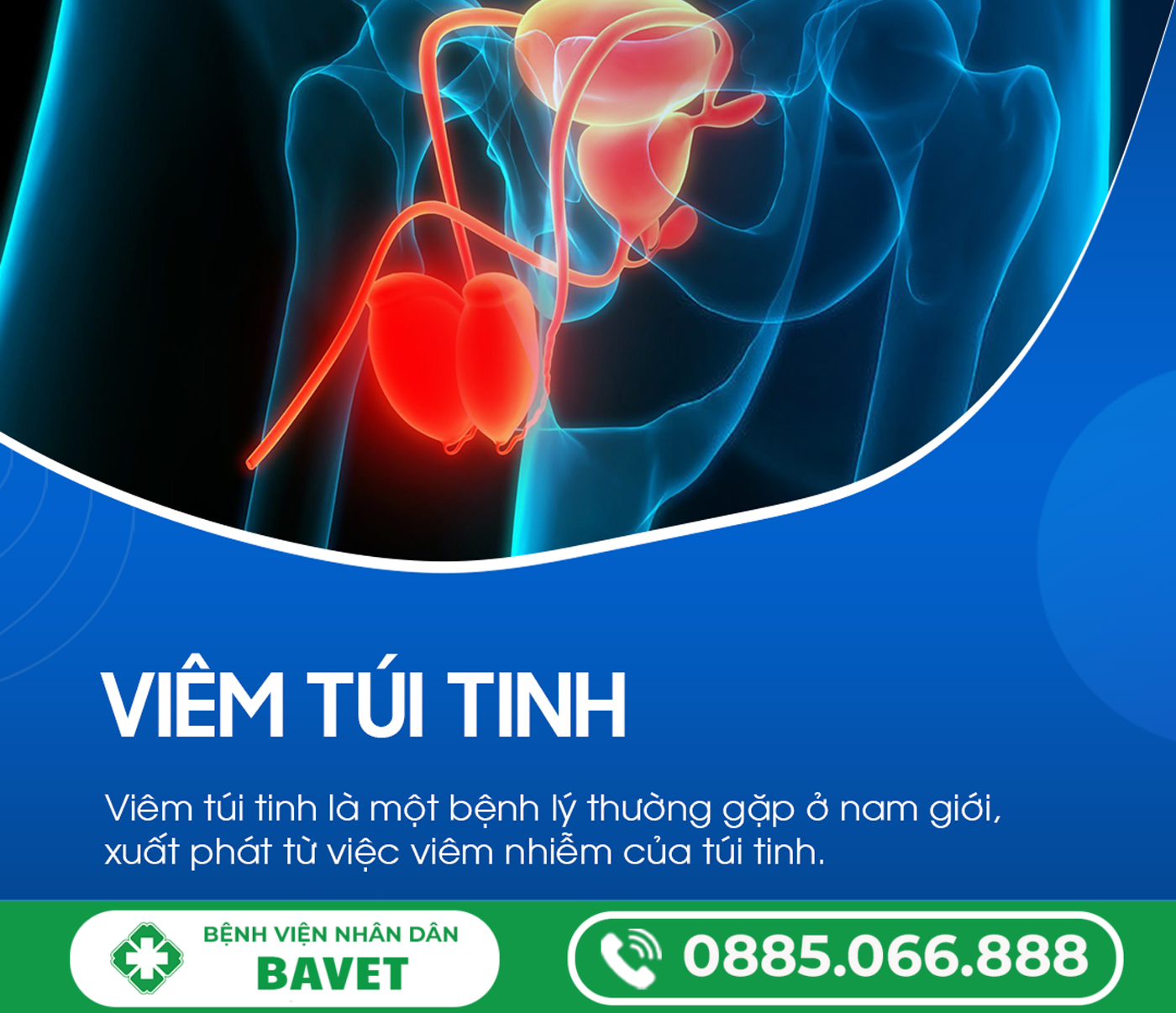 VIÊM TÚI TINH – NGUYÊN NHÂN, DẤU HIỆU VÀ MỨC ĐỘ NGUY HIỂM CẦN CẢNH GIÁC
