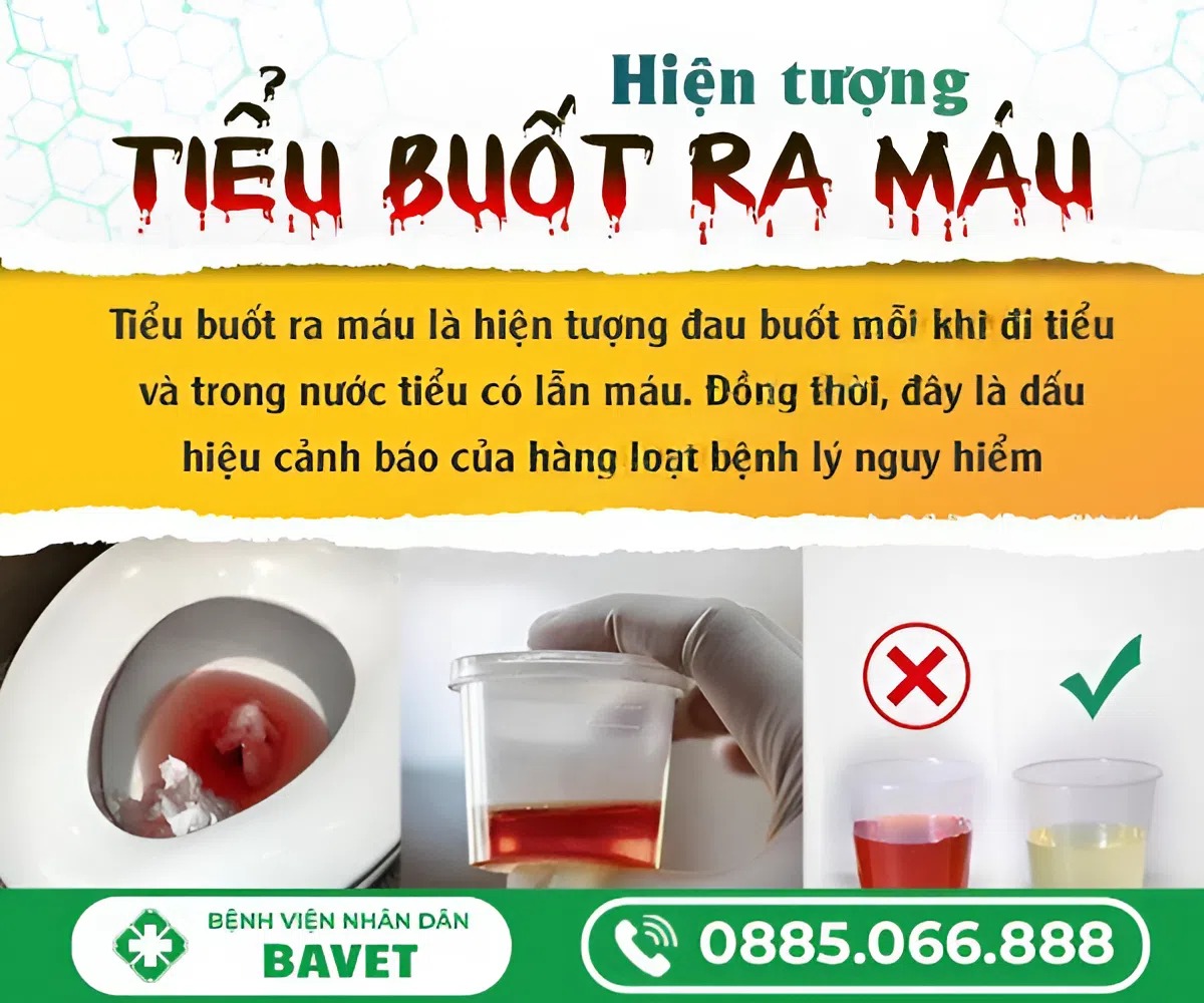 ĐI TIỂU BUỐT VÀ RA MÁU