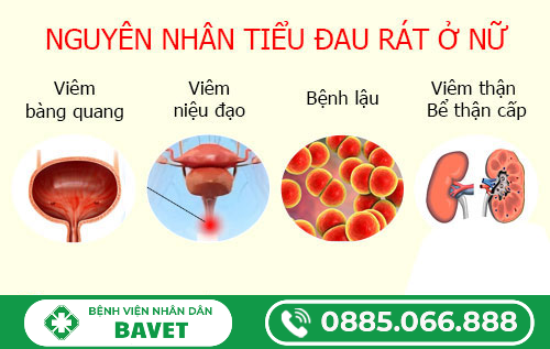 ĐI TIỂU ĐAU RÁT Ở NỮ GIỚI