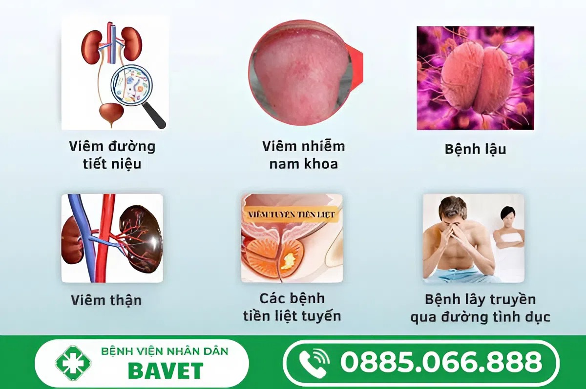 NGUYÊN NHÂN TIỂU BUỐT THƯỜNG GẶP