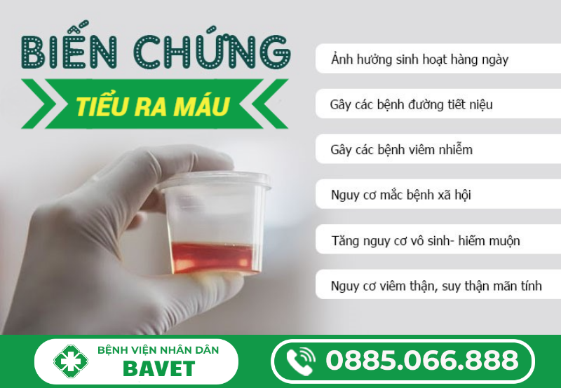 ĐI TIỂU RA MÁU CÓ SAO KHÔNG?