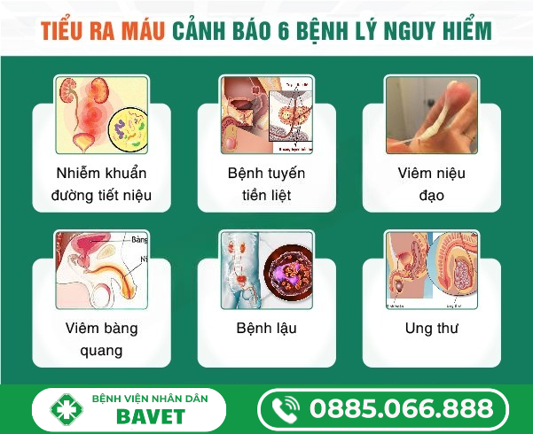 NGUYÊN NHÂN ĐÁI RA MÁU