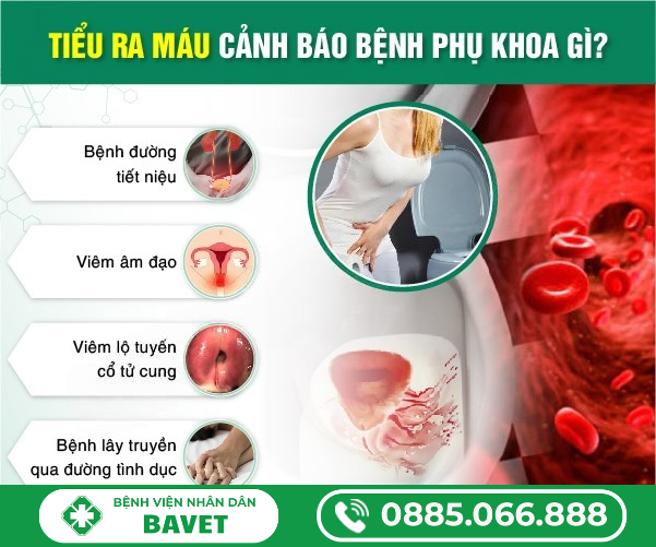 BỆNH ĐI TIỂU RA MÁU Ở NỮ GIỚI