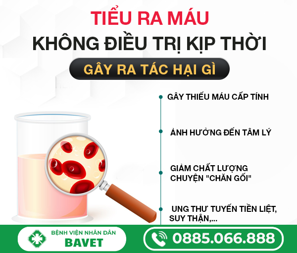 ĐI TIỂU RA MÁU LÀ BỆNH GÌ?